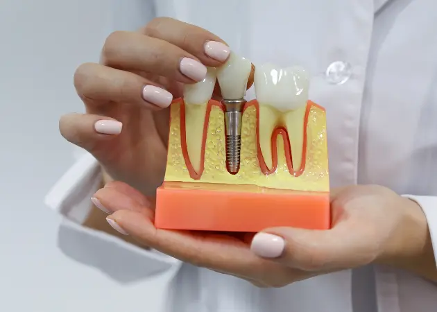 Clínica odontológica especializada em implantes dentários